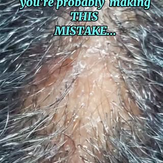 Is your scalp itchy, flaky, or experiencing unexplained hair loss? 🤔 It might be time for a scalp e