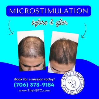 ❌️STOP THIS NOW!! 99% of people are ruining their hair without realizing it. 

If your hair is:
❓️Th