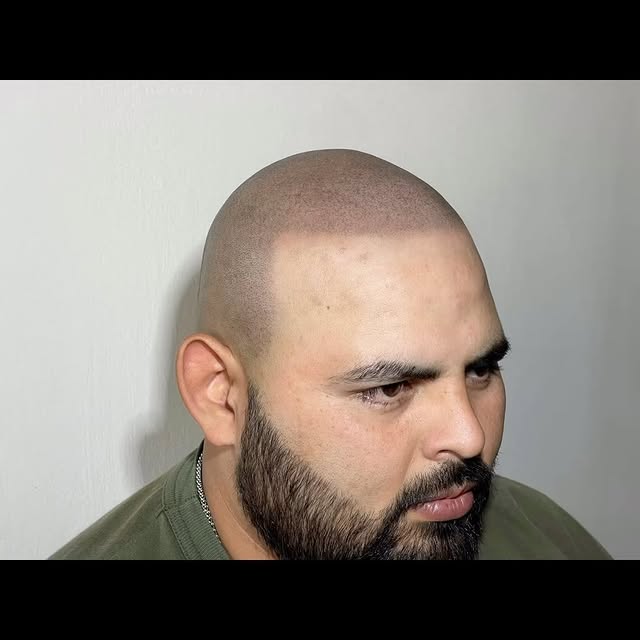 #micropigmentacioncapilar
