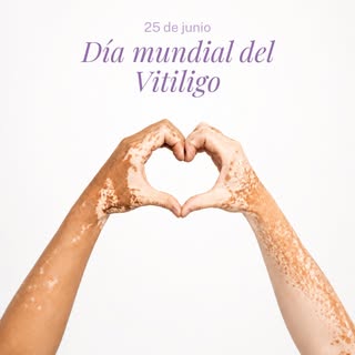 Hoy, en el Día Mundial del Vitiligo, hablamos de una condición de la piel que muchas veces viene aco