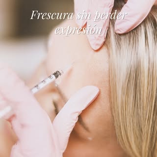 La toxina botulínica no se trata de cambiar tu expresión, sino de suavizar líneas dinámicas y lograr