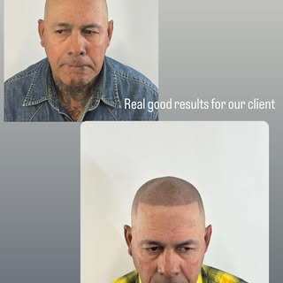 Free consultation‼️ %20 OFF if you mention this add‼️
2102901253