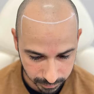 #micropigmentation #sanantonio