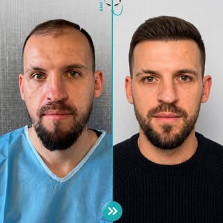 Me planifikim të saktë, teknikë profesionale dhe kujdes të personalizuar, arrihen rezultate natyrale