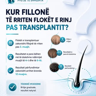 📌 PYETJE TË SHPESHTA

Kur fillojnë të rriten flokët e rinj pas transplantit? 🤔

Pas transplantit t