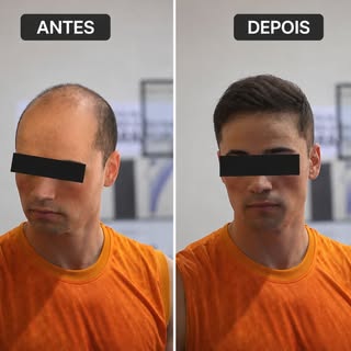 Um cabelo que ainda tem muito espaço para crescer e que já mudou completamente a feição do rosto em 