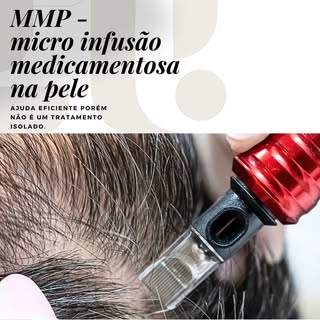 Tratamentos Personalizados para Queda de Cabelo e Calvície e Doenças de Couro Cabeludo
com especiali