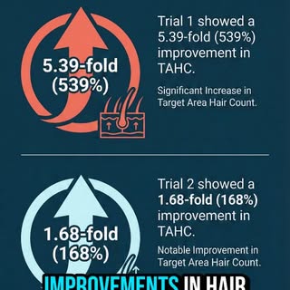 Block DHT without sexual side effects? Now it's possible. 

#clascoterone #hairloss #aga #dermatolog
