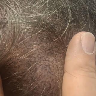 2026 looks good on this client! What do you think Are you ready as well come see me Roberto at Scalp