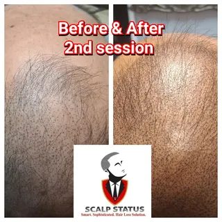 2 of 3 sessions to go!

2026 looks good on this client! What do you think Are you ready as well come