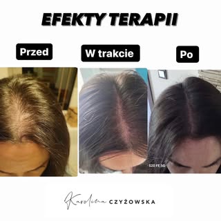 🤍 Pamiętacie jak wrzuciłam dwa pierwsze zdjęcia w zestawieniu efekty przed i po, mówiąc że „IDZIEMY