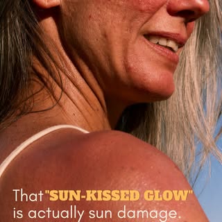 That “sun-kissed glow” is actually sun damage ☀️

That golden tan? It’s your skin’s defense response