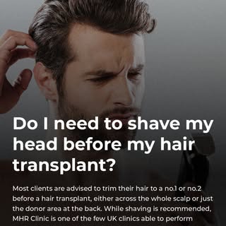 Thinking about a hair transplant but unsure about shaving your head? At MHR Clinic, most clients are
