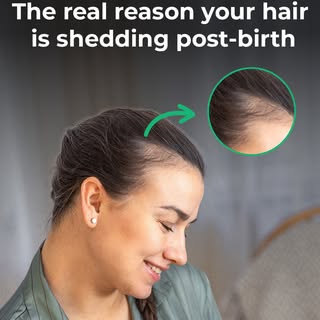 Have you noticed more hair shedding since giving birth? 👶💇‍♀️ If so, you're certainly not alone. 
