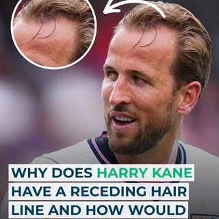 ⚽️ Harry Kane is known around the world for finding the back of the net but his hairline has attract