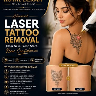 💎 **Erase the Ink, Keep the Confidence!** 💎

Thinking about removing an unwanted tattoo? With adva