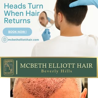 Learn more about the benefits of FUE Hair Transplant with us, visit here 👇
https://mcbethelliotthai
