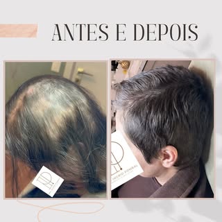 Três meses separam uma foto da outra. Mas essas imagens não são  apenas sobre fotos ou resultados…Sã