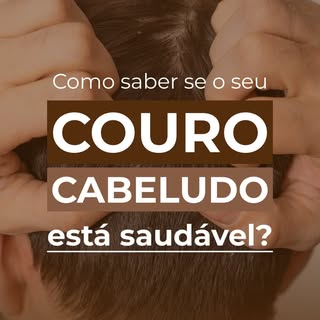 Queda aumentada, afinamento dos fios ou falhas visíveis não fazem um diagnóstico, mas são sinais de 