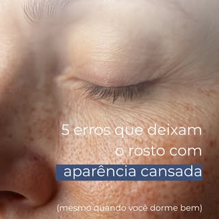 Nem sempre a aparência cansada tem relação com falta de sono ou apenas com rugas.

Existem outros fa