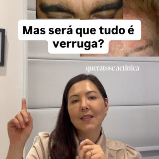 Mas agora me conta aqui, você também pensava que todas essas lesões eram verrugas? 

Entenda a difer
