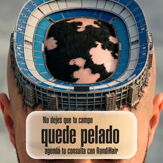 ¡El partido por tu cabello se juega hoy! 🏟️⚽

La pérdida de cabello no tiene por qué ser el resulta