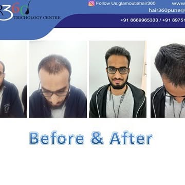 We Value Your Request With The Best Results #pune #hairstyles #hair360