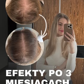 3 miesiące. Tyle minęło od pierwszej wizyty tej pacjentki.

Przyszła do mnie w grudniu z wyraźnie pr