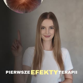 Pierwsze efekty w trakcie terapii ✨
To jeszcze nie koniec drogi, ale bardzo lubię ten moment - kiedy