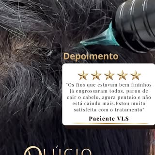 Nós temos os melhores pacientes.

Dr. Lúcio de Lima Duarte
CRM MG 43.692
Tricologia e Transplante Ca