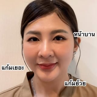 หน้าเรียว ไม่ต้องพักฟื้น ต้อนรับซัมเมอร์ !🦵🏻💦☀️

🌟✼ •• ┈┈┈┈┈┈┈┈┈𝐒𝐭𝐚𝐫 𝐂𝐥𝐢𝐧𝐢𝐜┈┈┈┈┈┈┈┈┈┈┈