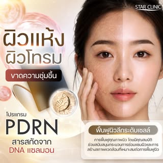 ฟื้นฟูผิวแห้งกร้าน เติมความชุ่มชื้นให้ผิวดูสุขภาพดีด้วย PDRN ✨
PDRN ช่วยสนับสนุนกระบวนการฟื้นฟูผิว พ