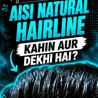 Bhai, ye hairline dekh ke koi nahi bolega ye NATURAL nahi hai. 😳
IHW ke alawa itna real hairline ka
