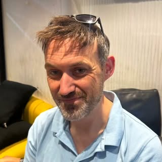 He flew in from the UK… just for THIS. 🇬🇧✈️
Watch how we restored his natural look in one sitting.