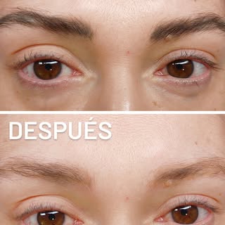 ⚡REMOCIÓN LÁSER DE CEJAS ⚡
✨Resultados en 1 sesión 
✨Sin dolor
✨Sin dañar el pelo
💥Promo Agosto $90