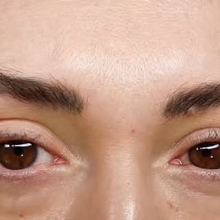 ⚡El láser para remover micropigmentación de cejas no daña el pelo, por el contrario, estimula el cre