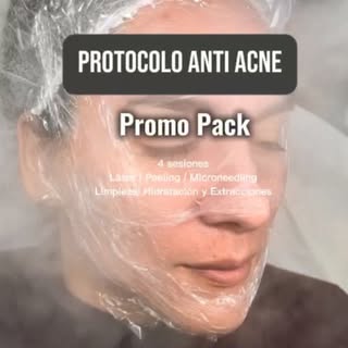 ✨Temporada de tratamientos! ✨
🙌A tomar en serio la salud de tu piel y ponernos en acción ya mismo p