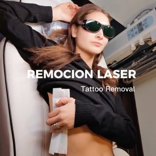⚡Tienes un tatuaje que quieres eliminar?
🌟En mi consulta tenemos la mejor tecnología, el nuevo  lás