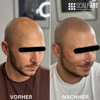 🤩🤩🤩
________________________________________________
#haarpigmentierung #smp #scalpmicropigmentat