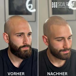 Die Erfahrung macht den Unterschied 🤩
________________________________________________
#scalp #smp 