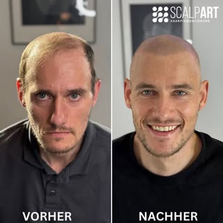 Was für eine schöne Transformation 😍
Nicht nur eine neue Optik sondern ein sichtbar neues Lebensgef