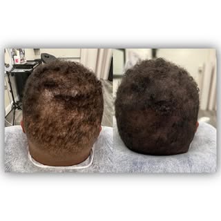 Thinning? I got you! Let’s get you feeling and looking 10 years younger. Results guaranteed! 

Work 