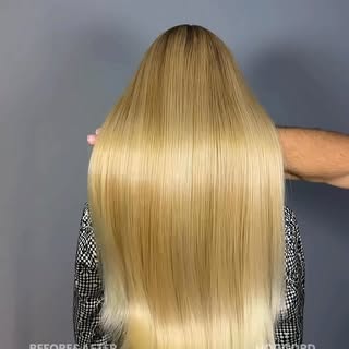 Even in the most complex cases, visible results can be achieved from the very first procedure.

This