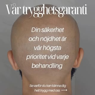 Vår Trygghetsgaranti – Scalp Micropigmentation 🕊️

𓂀 Kostnadsfri konsultation – Vi lyssnar på dina