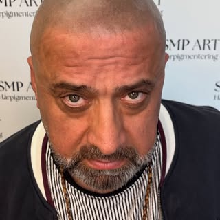 Scalp Micropigmentation Före och efter ✨
Kundens önskemål: En mörk, tydlig och markant hårlinje med 