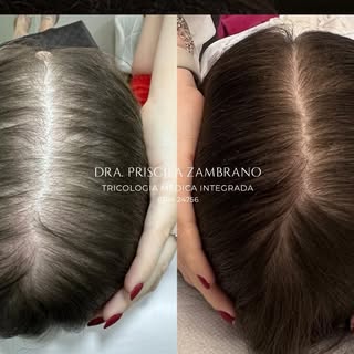 ✨ Uma história que o cabelo conta ✨

Ela chegou tímida, carregando no olhar uma tristeza que falava 