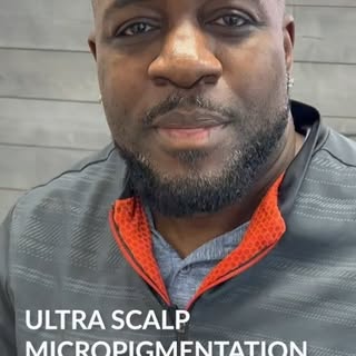 Scalp MIcropigmentation Tampa- Add the look of more density or Get Your Hairline Back with the shave
