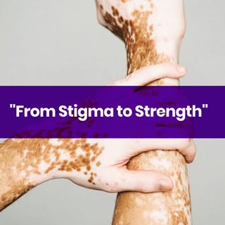 Every skin tells a story, and every story deserves understanding. 🤍
This Vitiligo Awareness message