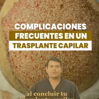 ¿Te realizaste un trasplante capilar? 😱
Conoce los síntomas que debes tener en cuenta durante tu po