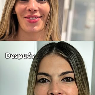 ✨Hoy compartimos la experiencia de armonización facial de Dai @daiatrejo bella novia de Eddie @eddie